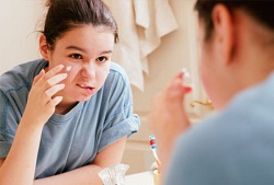Лечение угрей на лице: эффективные советы